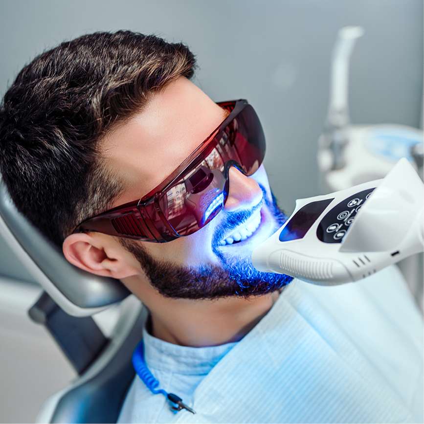 Young man whitening his teeth